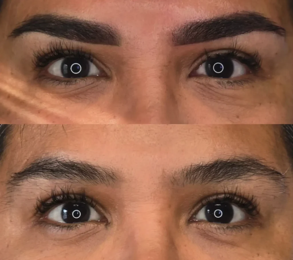 cosmetic tattoo