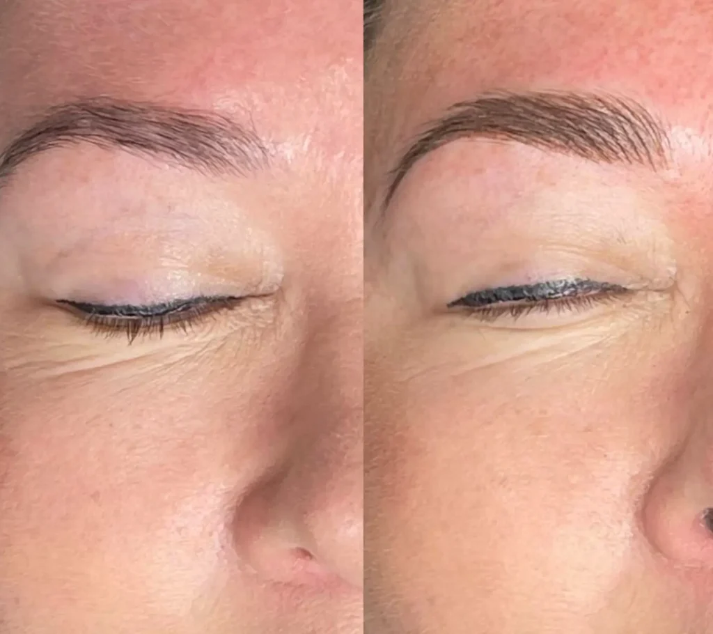 cosmetic tattooing Brisbane