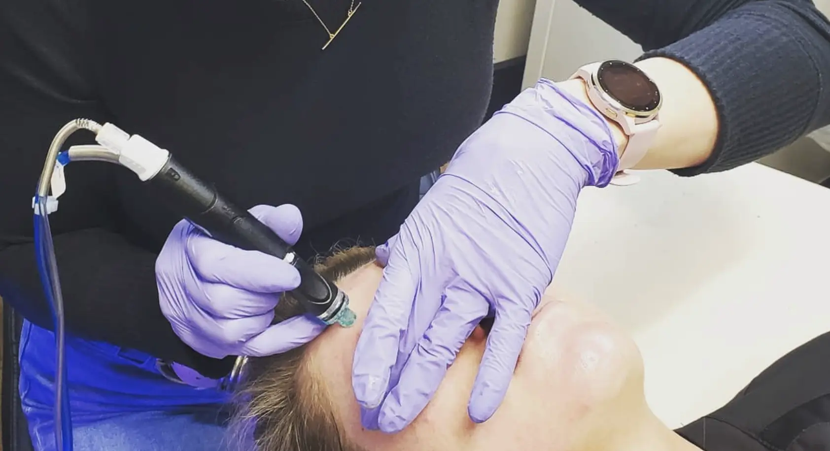 hydrafacial Brisbane